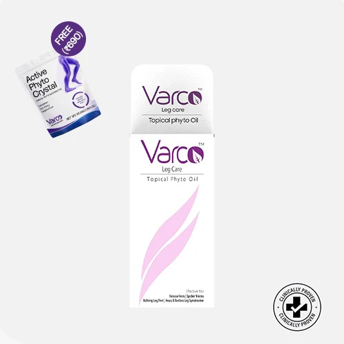 Varicose Veins Mild