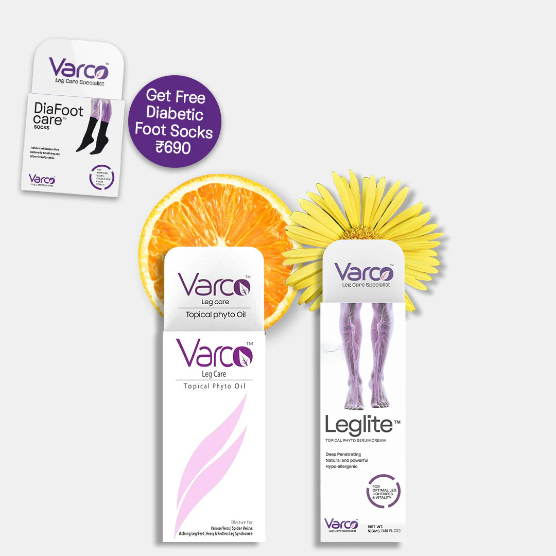 Varicose Veins